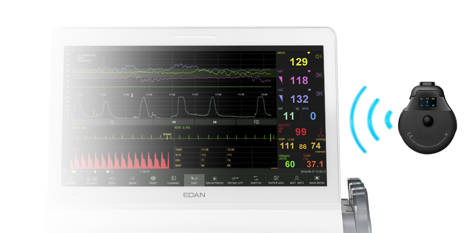 MONITOR FETAL F15 AIR, MARCA EDAN
